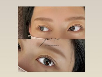 ポコ(poco)/ラッシュリフト