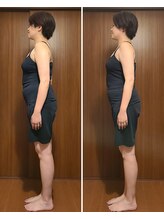 テマモリ(temamori)/施術ビフォーアフター