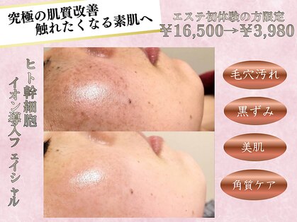 エソール(essor)の写真