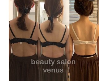 ヴィーナス(Venus)/バストアップで肩甲骨矯正も！