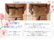 ミライ 福岡春日店(mirai)/お客様の声と効果写真