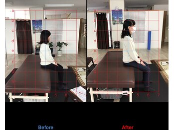 ストレチックス 近江八幡店/慢性的な肩こり、産後ケア