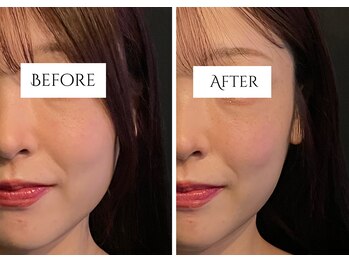 クク 赤坂 天神(99 KUKU)/【むくみ】【ほうれい線】