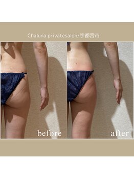 シャルナ(Chaluna)/諦めてたヒップアップ☆