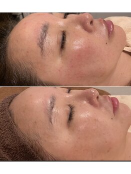 トータルエステティック ジョワイユ(JOYEUX)/エステの常識を超えるサロン