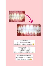 エクシアホワイト 山形西バイパス店/ビフォーアフター