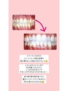 エクシアホワイト 山形西バイパス店/ビフォーアフター