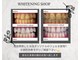 ホワイトニングショップ 札幌(Whitening Shop)の写真