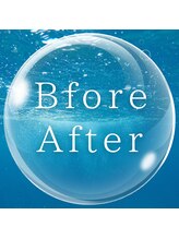 ブランロップ(BLANC LOP)/＼Bfore/Afterののご紹介／
