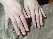 メロー(Meloo)/ハンドケアスパ