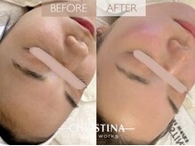 サロンブランシュ(salon BLANCHE)/お肌の土台を整える！艶肌の秘訣