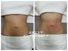 拘縮ケアもOk☆