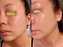 エミナス(EMINAS)/圧倒的透明感！糖化肌、黄ぐすみ