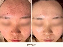 マイナプラ 表参道(myna+)/CHRISTINA/ROSEDEMER