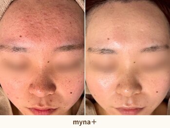 マイナプラ 表参道(myna+)/CHRISTINA/ROSEDEMER