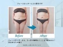 ジェイレナータ(J.RENATA)/