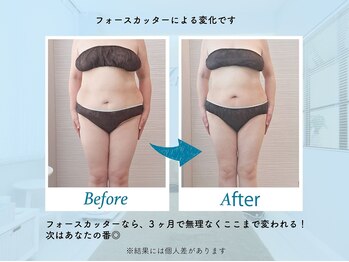 ジェイレナータ(J.RENATA)/