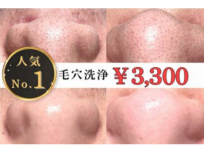 ディエール(Diailes)の写真