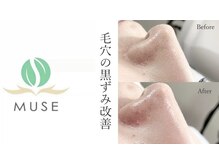 ミューズ 成城(MUSE)/