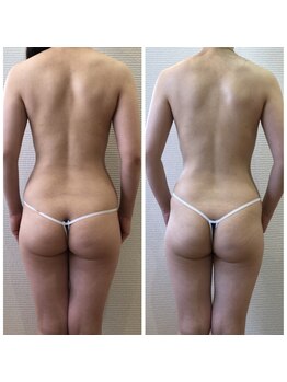 カロン(Kalon)/完璧な後ろ姿に