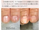 地爪育成コース【3ヵ月(全8回)】