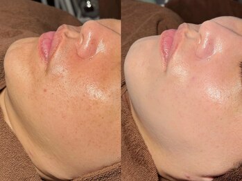 ルーナジェーナ(Luna llena)/池袋　エステ　ルーナジェーナ