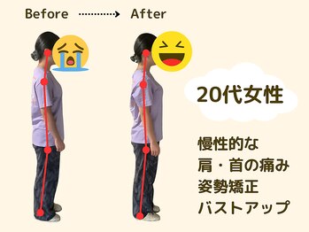 アロゼ/美容整体　20代女性