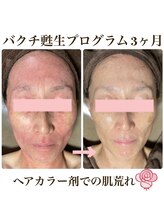 シエル(Ciel)/次世代レチノール《バクチ甦生》