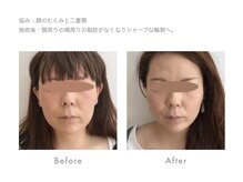 フィラメント ホンアツギ(Filament HONATSUGI)の雰囲気（小顔）