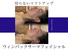 五感プラス(五感Plus)/まるで切らないリフトアップ☆