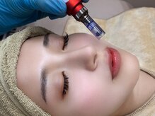 スア(SUA)/MTSダーマ使用韓国アンプル導入