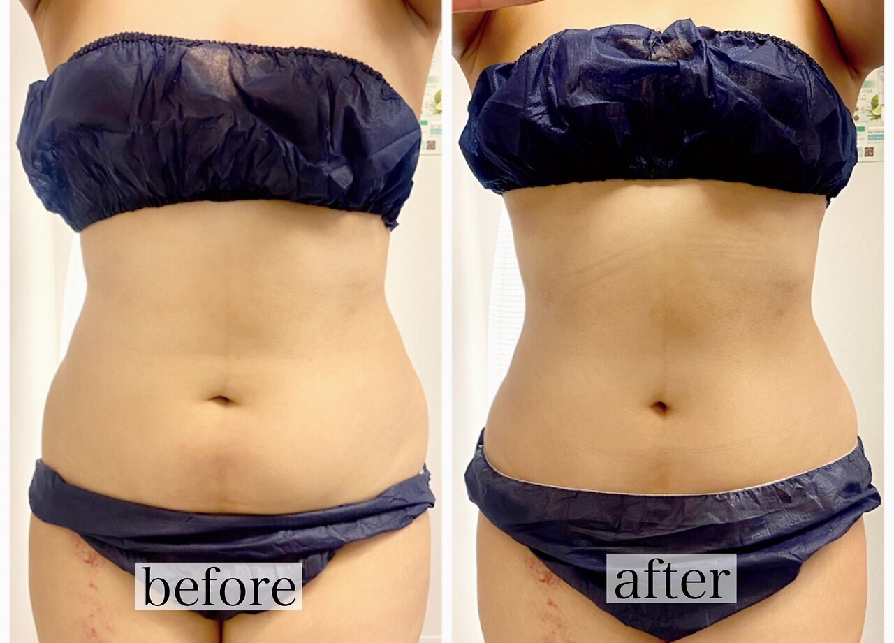 インディバ 頭皮に関するサロン BELRIZE-INDIBA Salon-など