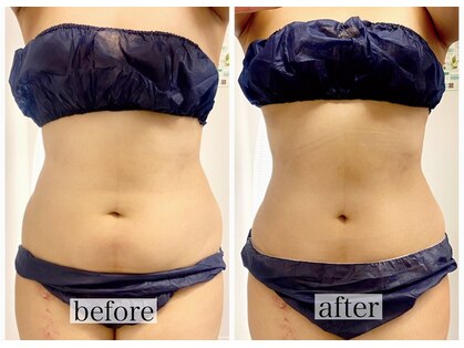 サロンドブーケ 上本町店(salon de bouquet)の写真