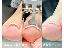 アネル(anel)の雰囲気(痛みの少ない巻き爪ケアでお悩み解消!)