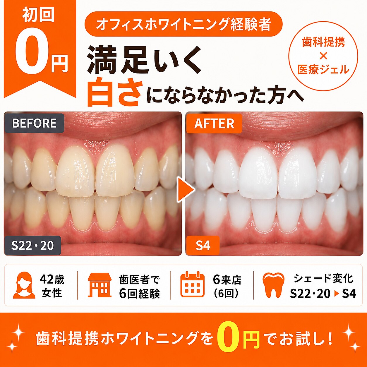 クーポン・メニュー｜ホワイトニングセンター 広島福山駅前店