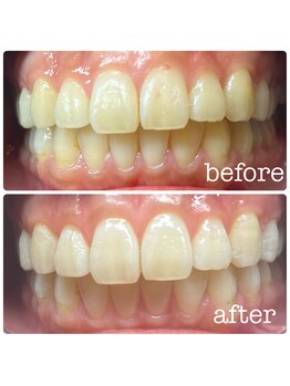 ビューティールームウィズ(beauty room w/)/