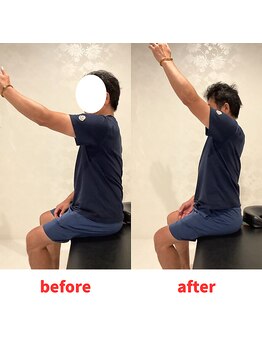 ナオル整体 福岡香椎院(NAORU整体)/50代男性施術事例【肩の痛み】