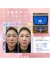水素吸入HHO☆ハイディーナダイエット/小顔/毛穴/初回¥6000→OP¥4000(60h)
