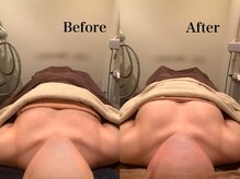 ジェイオー(J.O)/バストアップコルギ/小顔コルギ