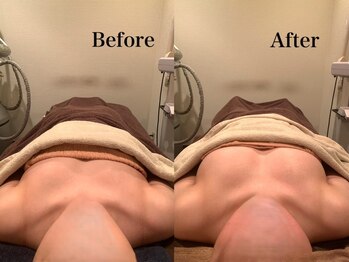 ジェイオー(J.O)/バストアップコルギ/小顔コルギ