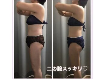 ミロク(369)/脂肪冷却×電磁パルスB→A