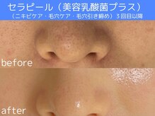 サロン ウーカ(salon WOOCA)/セラピール