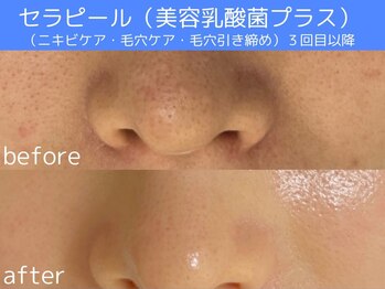 サロン ウーカ(salon WOOCA)/セラピール