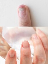 ネイルライフ(NailLife)