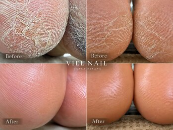 ヴィエル ネイル(VIEL NAIL)の写真/『選んだ瞬間、後悔ゼロ。』　エスプランニングで削るを超えた美しさを手に入れる。蓄積角質ごっそり除去/