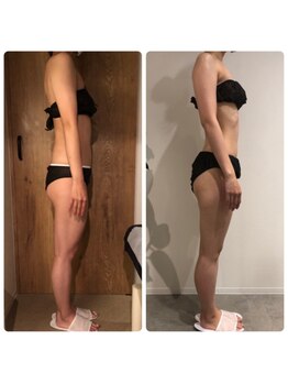 エイジングケアサロン 青山 本店/ビフォア・アフター!