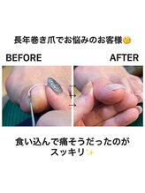 ココリ(CoCoRe)/巻いている爪