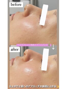 クレヴィー(Creviy)/1度で完結できるフルオプション