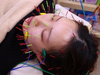 ながれかわ整骨院の写真/別府の口コミ大好評の整骨院！お肌の内側からアプローチしフェイスラインの引き締めや小顔効果も♪