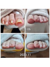 爪切り屋 足楽/定期ケアとフットウェア
